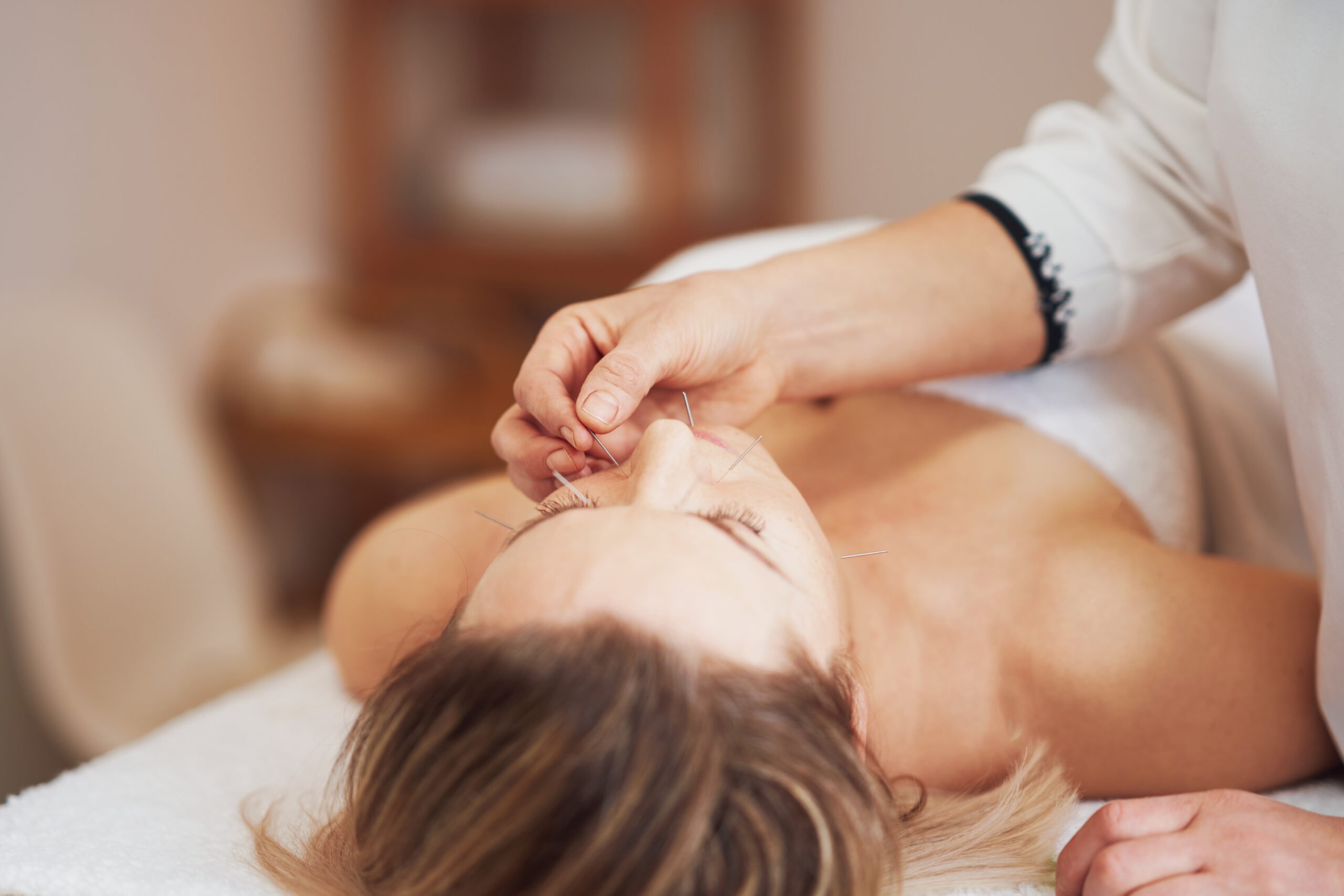 A acupuncture needle therapy in the studio. High quality photo